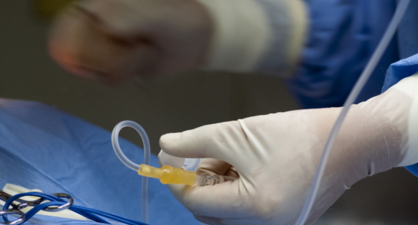  intermittent catheter 