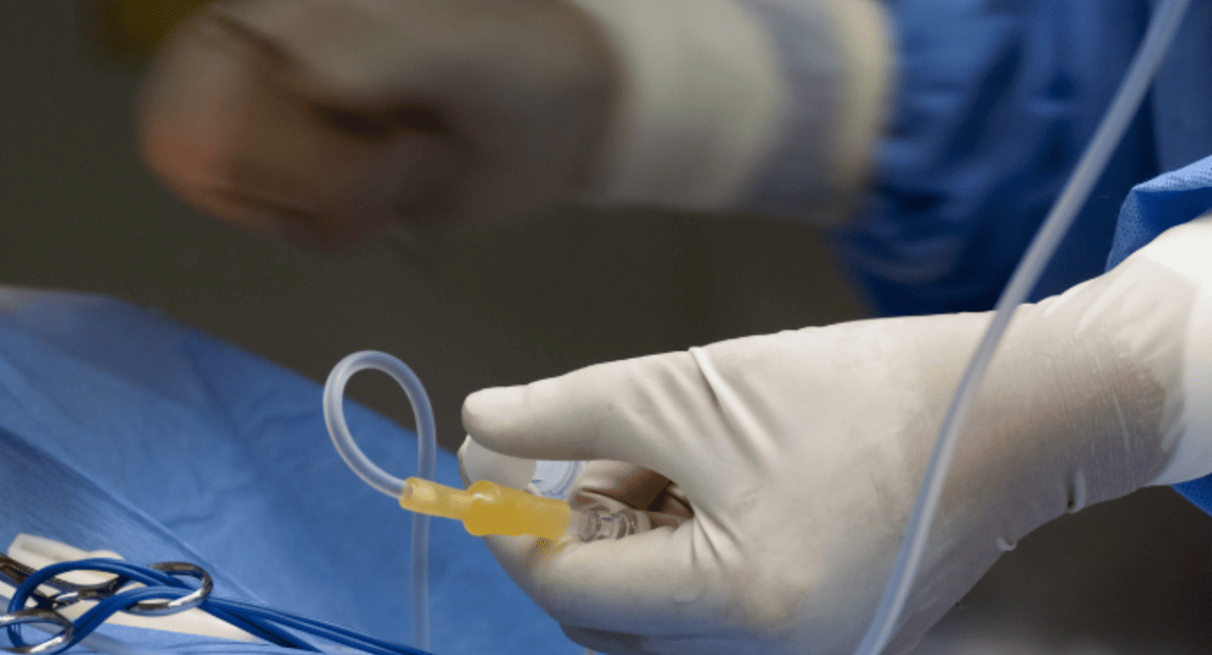 intermittent catheter